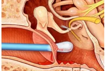 Kulak Temizleme Gliserin Kullanımı ve Faydaları Nelerdir?