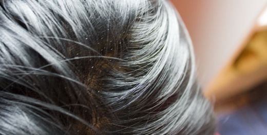 Gliserin Zararları Nelerdir?